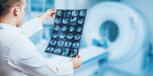 Radiologist looking at brain scans