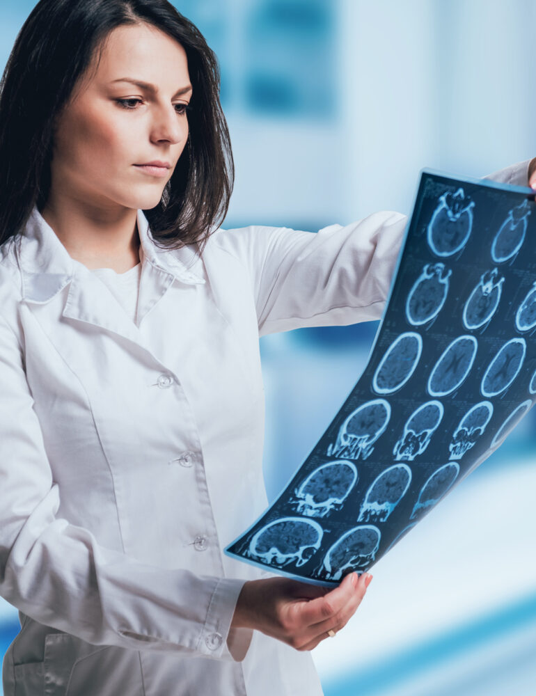 Radiologist looking at brain scans