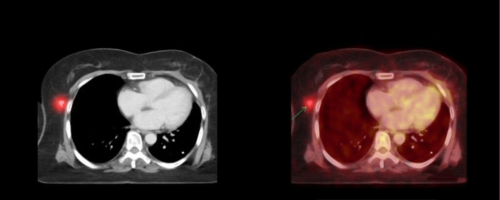 Medical imaging results