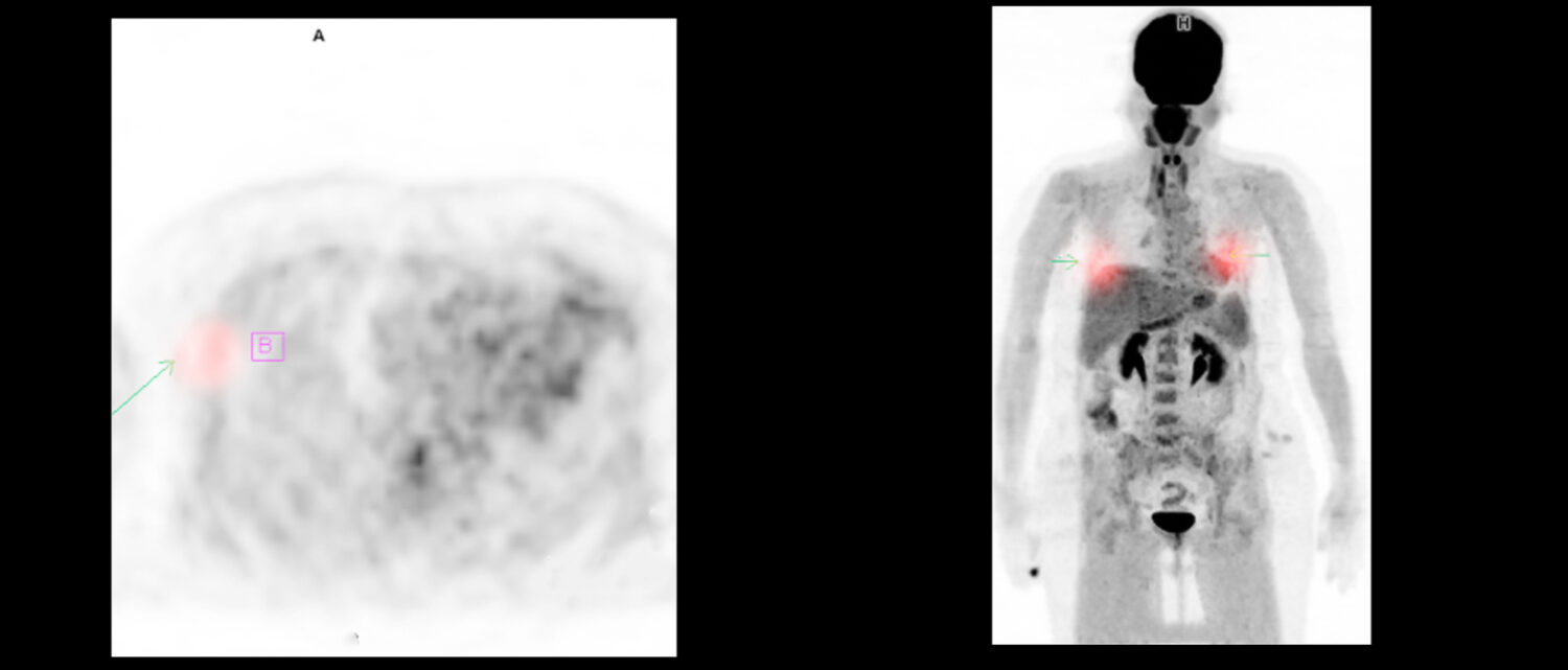 PET/CT: The Fastest Growing Diagnostic Imaging Modality