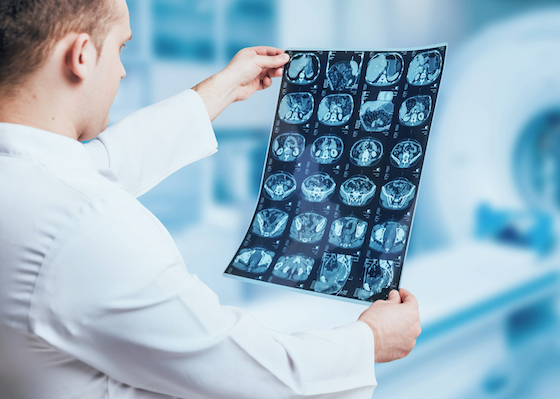 Radiologist looking at brain scans